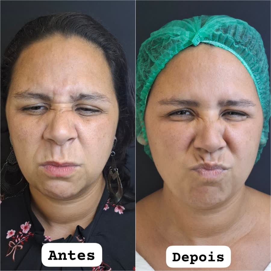 Resultado antes e depois 1