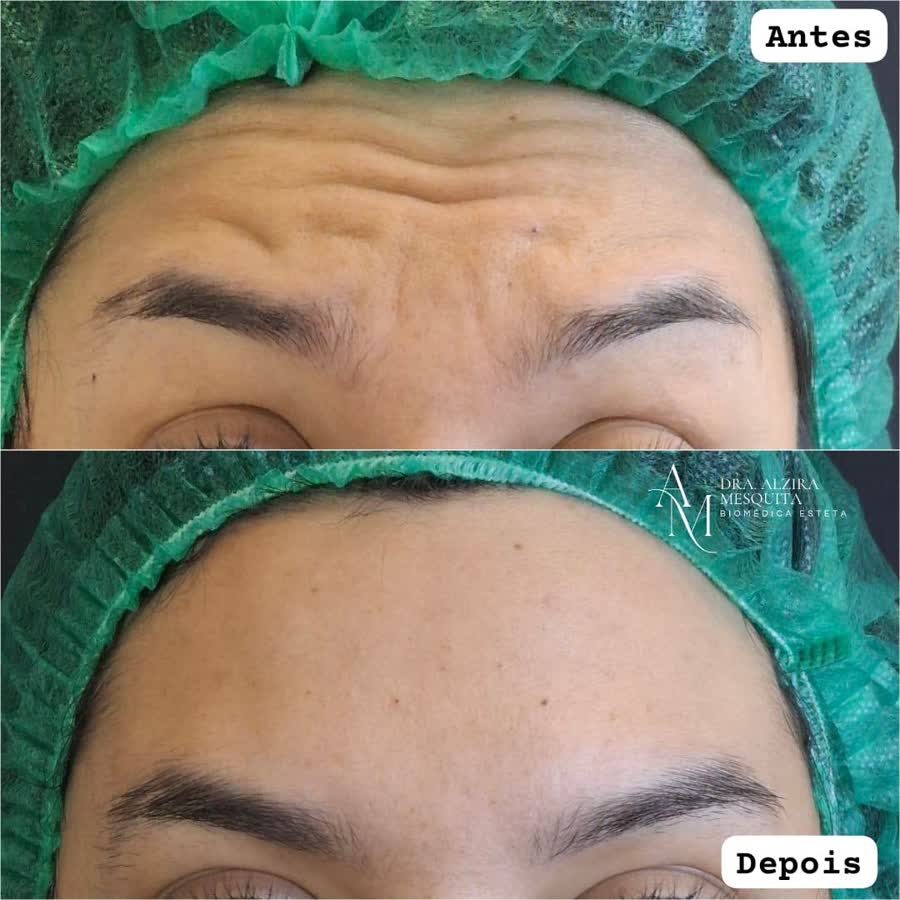 Resultado antes e depois 7