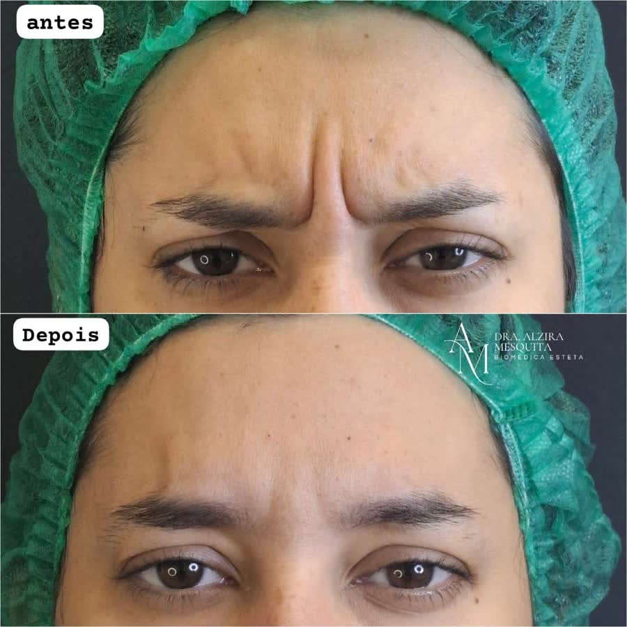 Resultado antes e depois 8