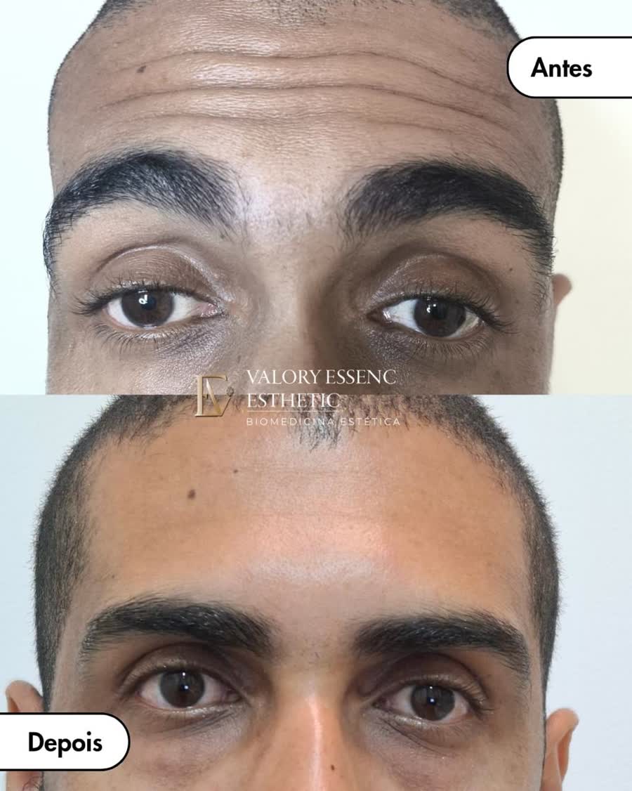 Resultado antes e depois 9