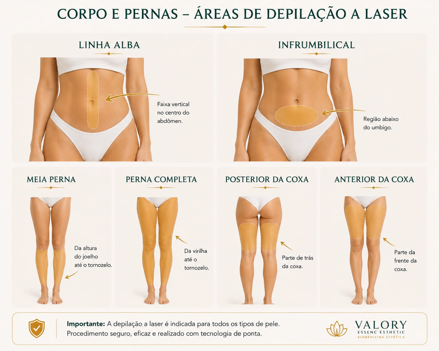 Guia de depilação a laser: Corpo e pernas