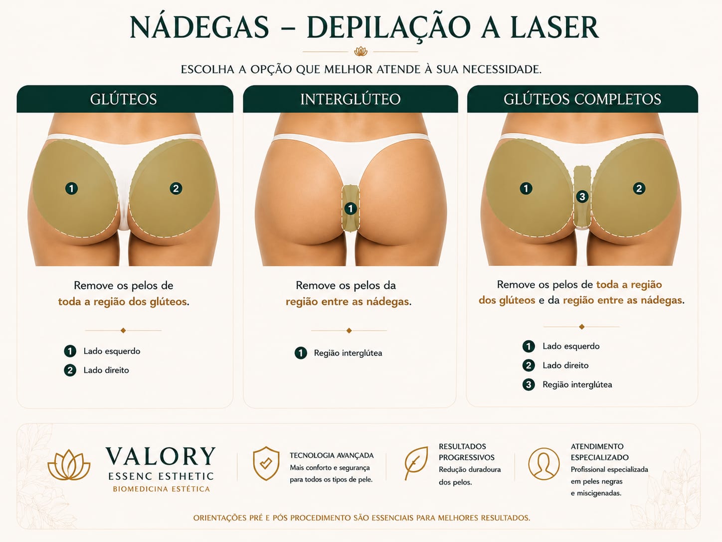 Guia de depilação a laser: Glúteos e interglúteo
