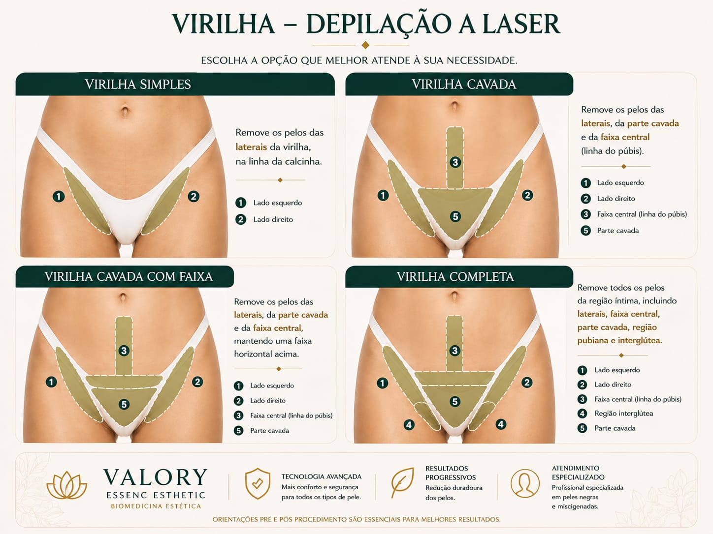 Guia de depilação a laser: Virilha — todas as opções