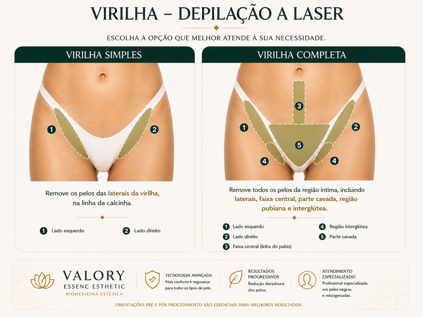 Guia de depilação a laser: Virilha simples ou completa
